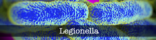 Boton_sub_tam_legionella-01
